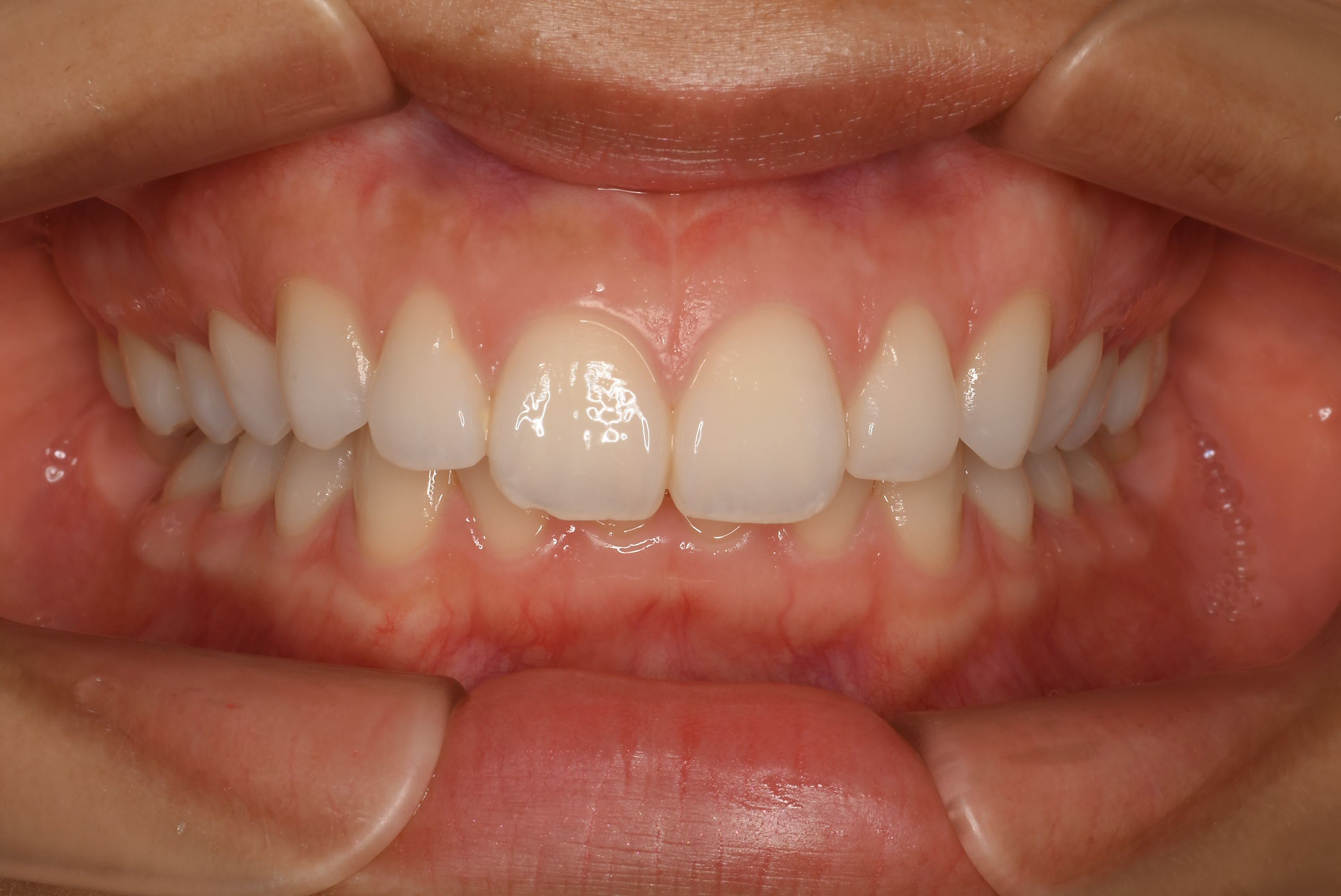 阿久沢 花帆2019.06.07_A005