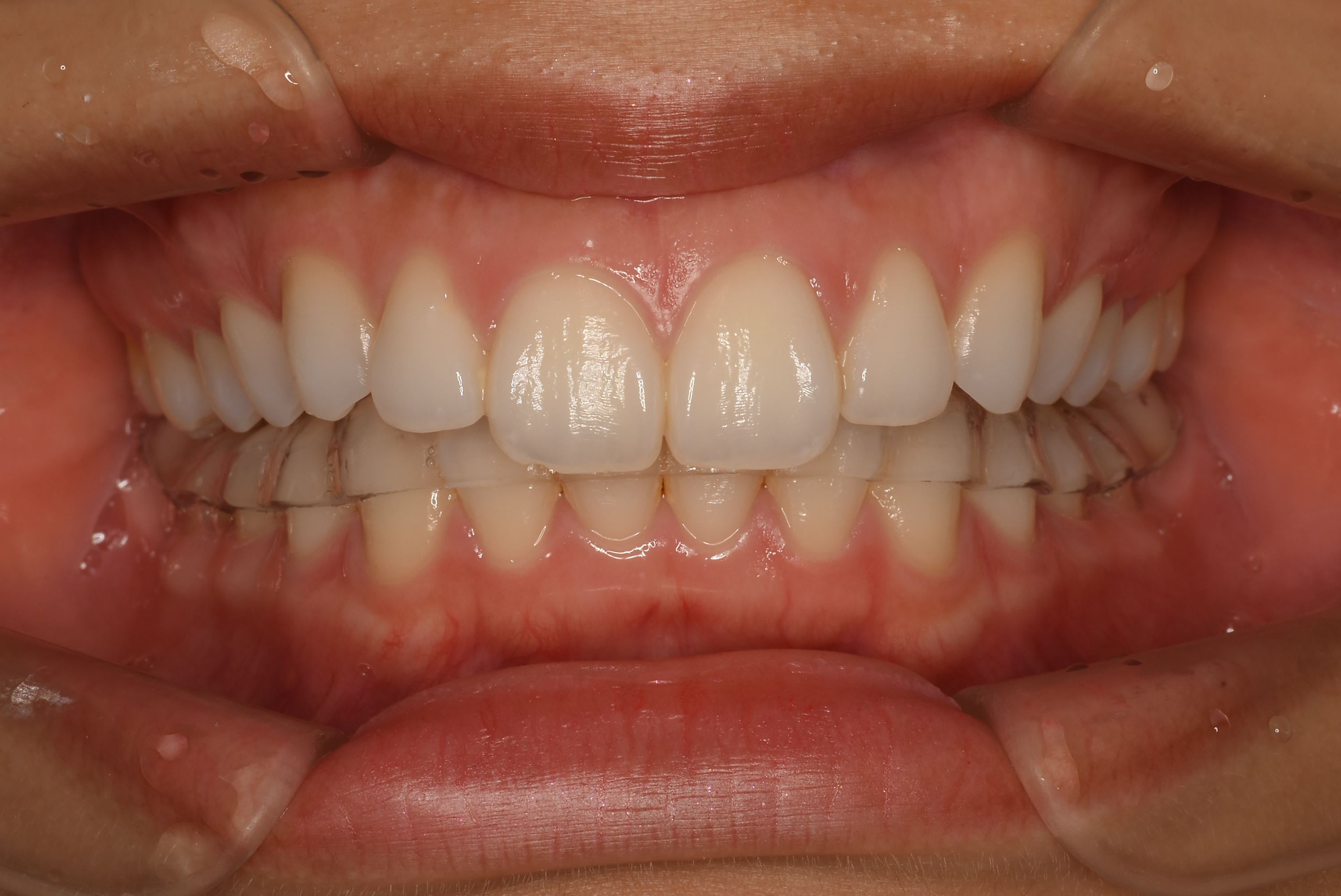 阿久沢 花帆2020.01.19_A005