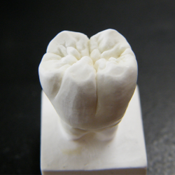 彫刻やります！ | 新浦安の歯医者・歯科｜栗林歯科医院｜各専門医在籍